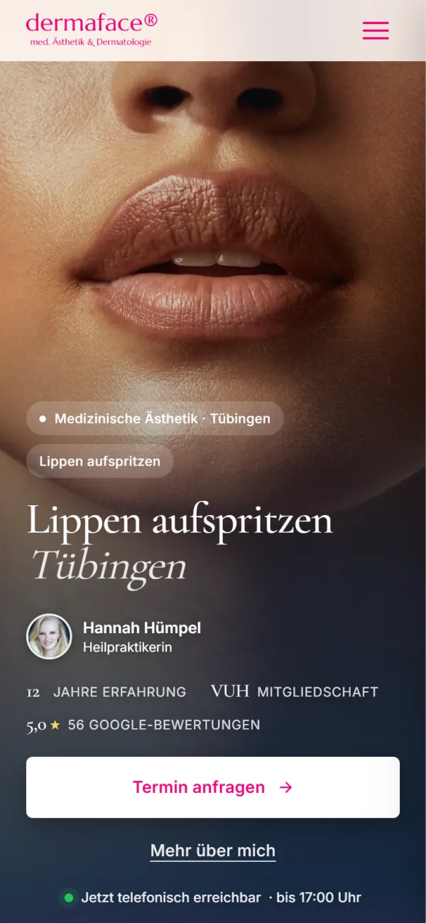 Screenshot der Landingpage Lippen aufspritzen in Tübingen auf dem Handy